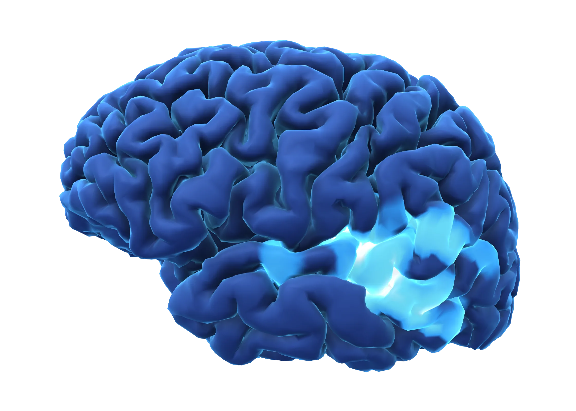 Cortical surface reconstructed from MRI, seen from the left, with an auditory source estimate shown from blue to white around the Sylvian fissure and upper temporal lobe.