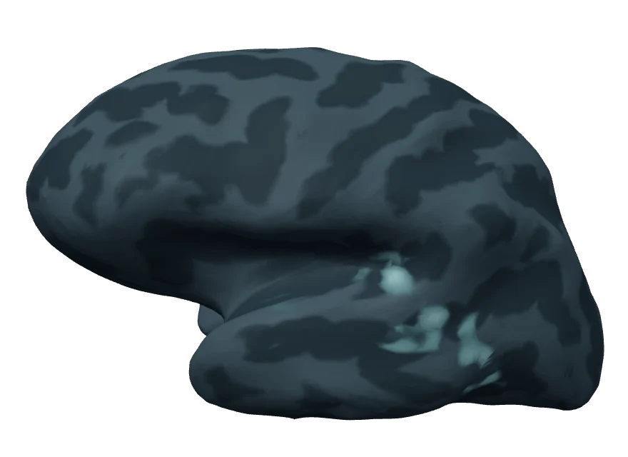 Inflated left hemisphere 125 milliseconds after tone onset; the estimate is concentrated around the auditory cortex.