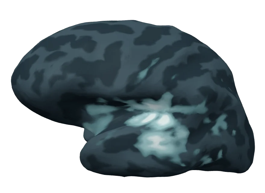 Inflated left hemisphere 75 milliseconds after tone onset; the estimate is concentrated around the auditory cortex.